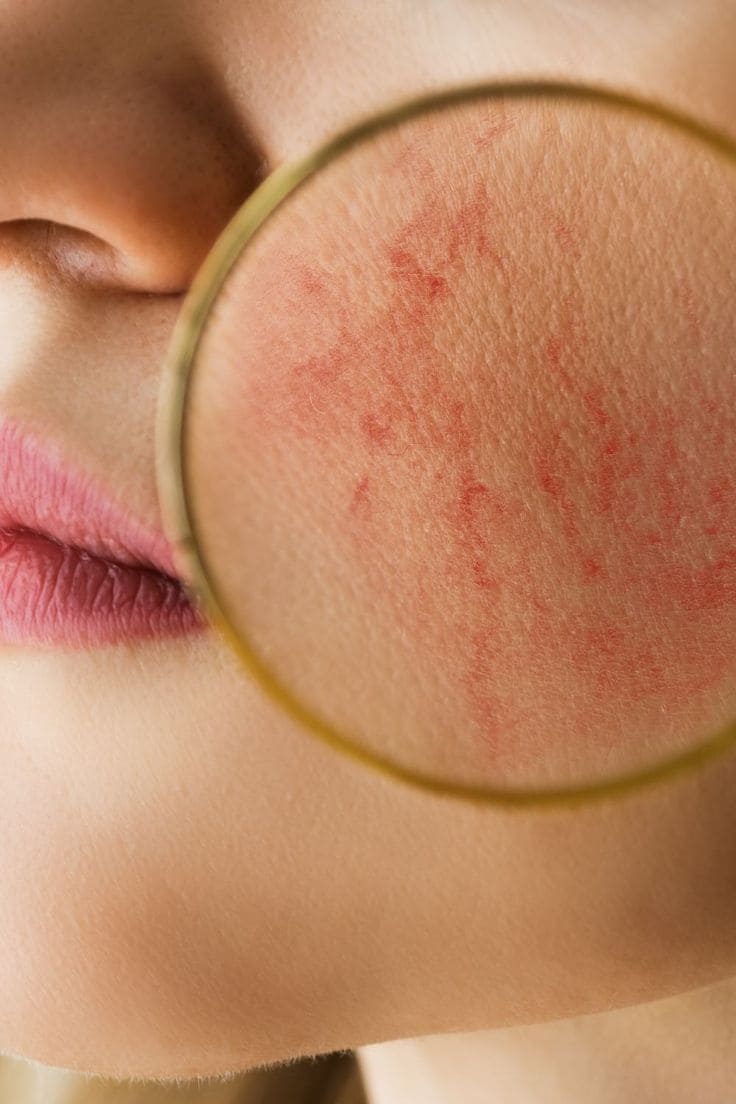 6 Bước Chăm Sóc Da Trước Khi Đi Biển Chia Sẻ Từ Chuyên Gia 12 Top Những Điều Cần Quan Tâm Đến Chăm Sóc Da Trước Khi Đi Biển - Tránh xa những “quân thù” của da trước chuyến đi