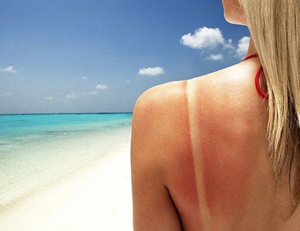 Hướng Dẫn Cách Chọn Kem Chống Nắng Body Đi Biển Đúng Cách Cho Da Nhạy Cảm 3 Da Nhạy Cảm Như Mình Và Nỗi Sợ Ánh Nắng Biển