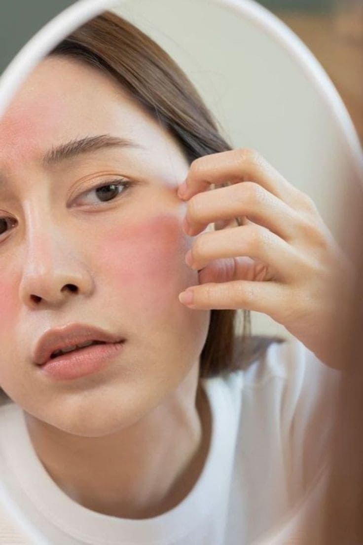 Hành Trình Phục Hồi Da Sau Đi Biển Lời Khuyên Từ Bác Sĩ Tín Đồ Du Lịch 3 Tại Sao Da "Khóc Thầm" Sau Chuyến Đi Biển?