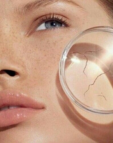 Hành Trình Phục Hồi Da Sau Đi Biển Lời Khuyên Từ Bác Sĩ Tín Đồ Du Lịch 4 Tại Sao Da "Khóc Thầm" Sau Chuyến Đi Biển?
